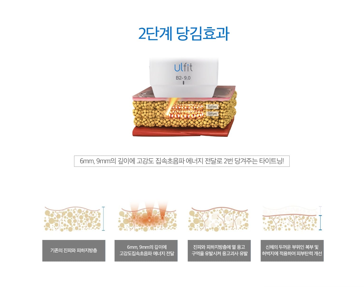 울핏 원리 마곡피부과 닥터에버스