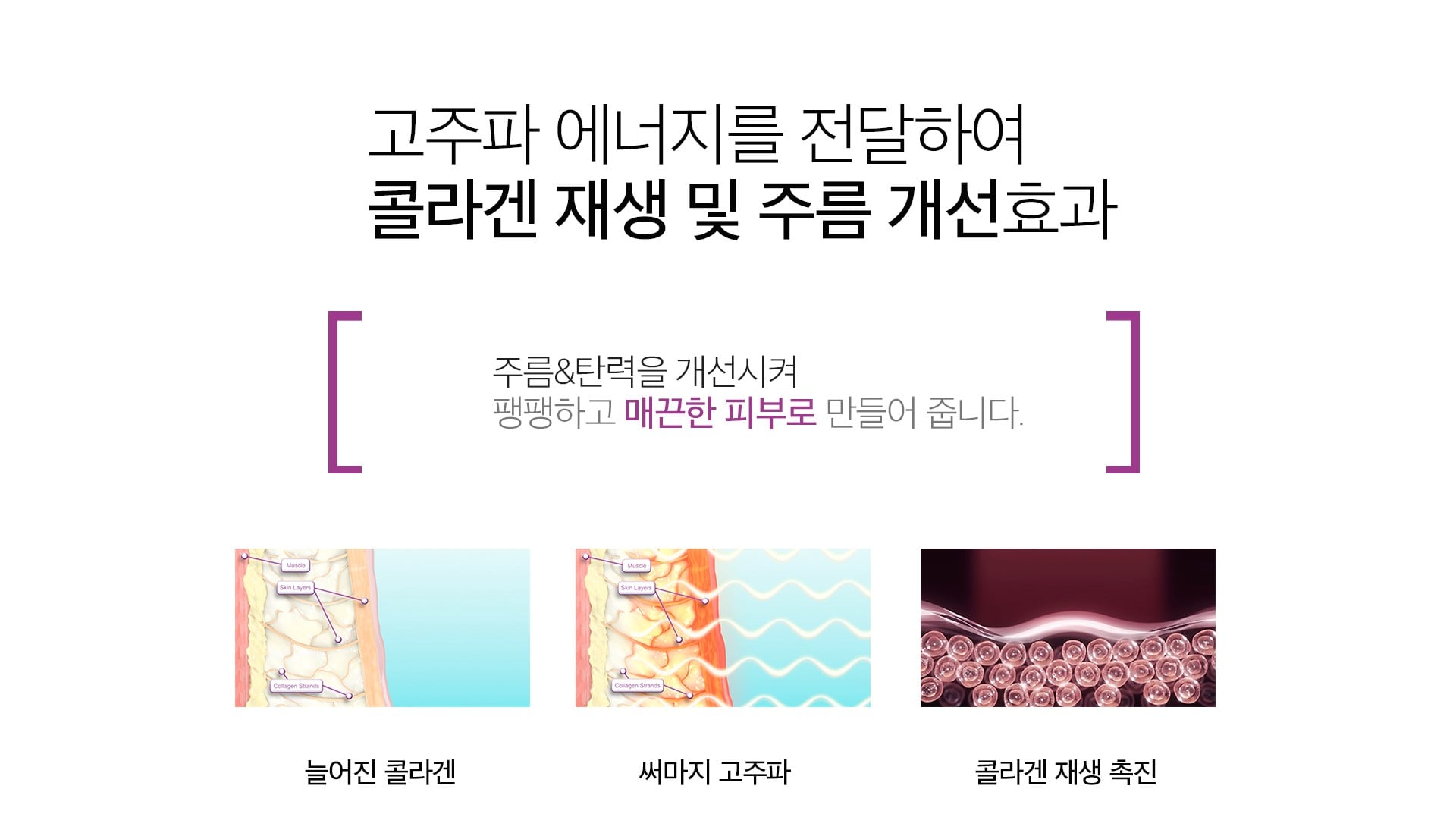 써마지 원리 마곡피부과 닥터에버스 써마지 원리 마곡피부과 닥터에버스