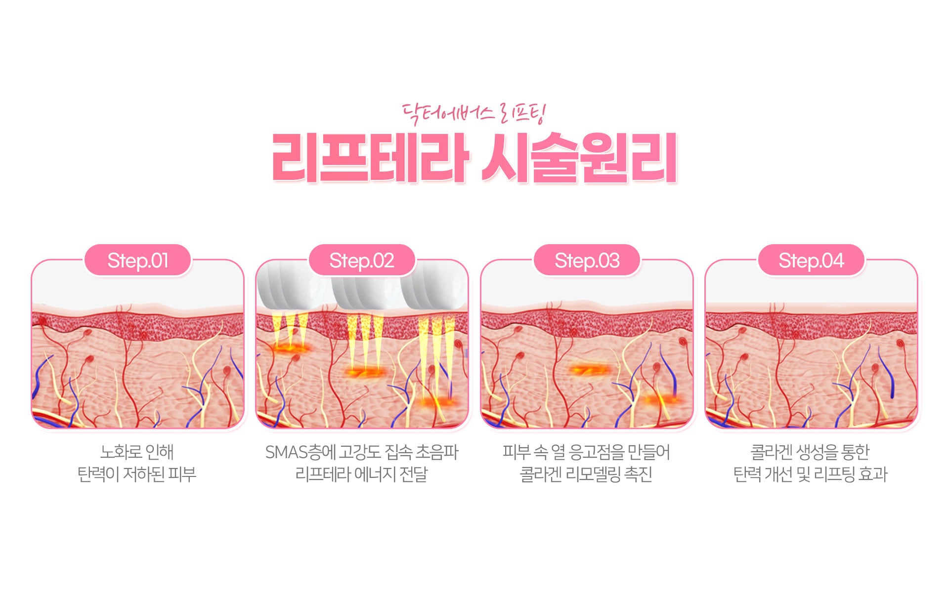 리프테라 원리 마곡피부과 닥터에버스